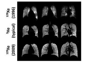 Lung images